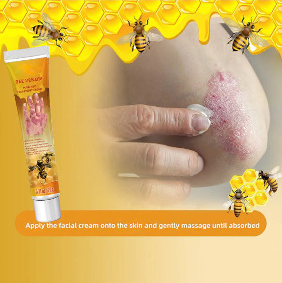 Bee Venom Psoriasis Treatment Cream(Suitable for all skin conditions)