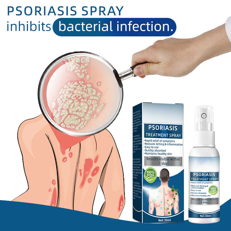 Psoriasis Treatment Spray
