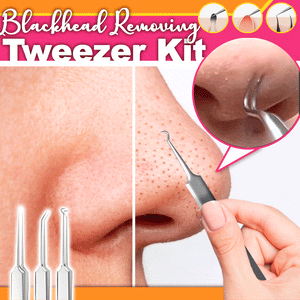 Professional Facial Blackhead Removing Tweezer Kit